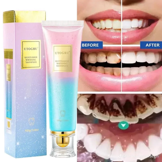 UTOGRU Whitening Toothpaste with Free Toothbrush – Teeth Brightening & Fresh Breath Formula