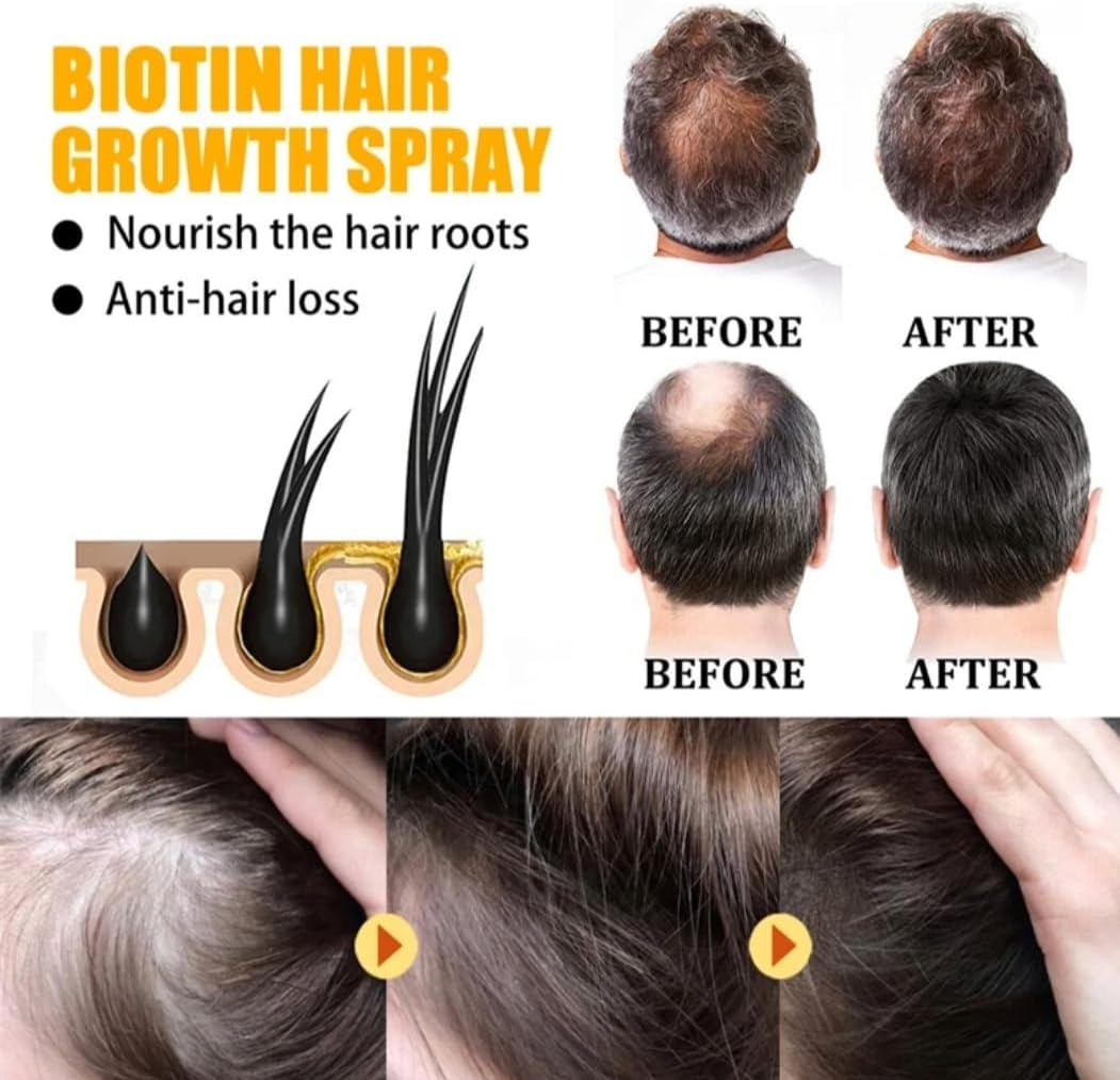 Biotin Hair Growth Serum by EELHOE - Anti-Hair Loss Treatment, Hair Thickening Serum, Strengthening & Revitalizing - 30ml