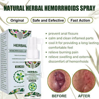 Hemorrhoid Relief Spray – Natural Herbal Soothing Treatment for Swelling, Itching & Discomfort Support