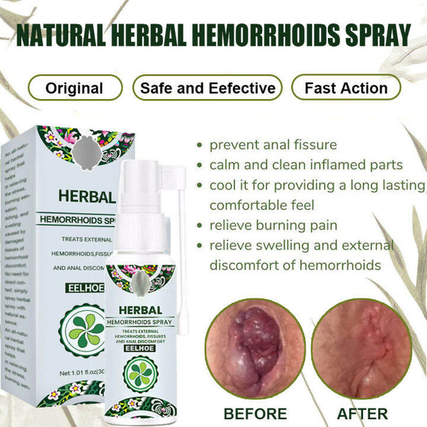 Hemorrhoid Relief Spray – Natural Herbal Soothing Treatment for Swelling, Itching & Discomfort Support