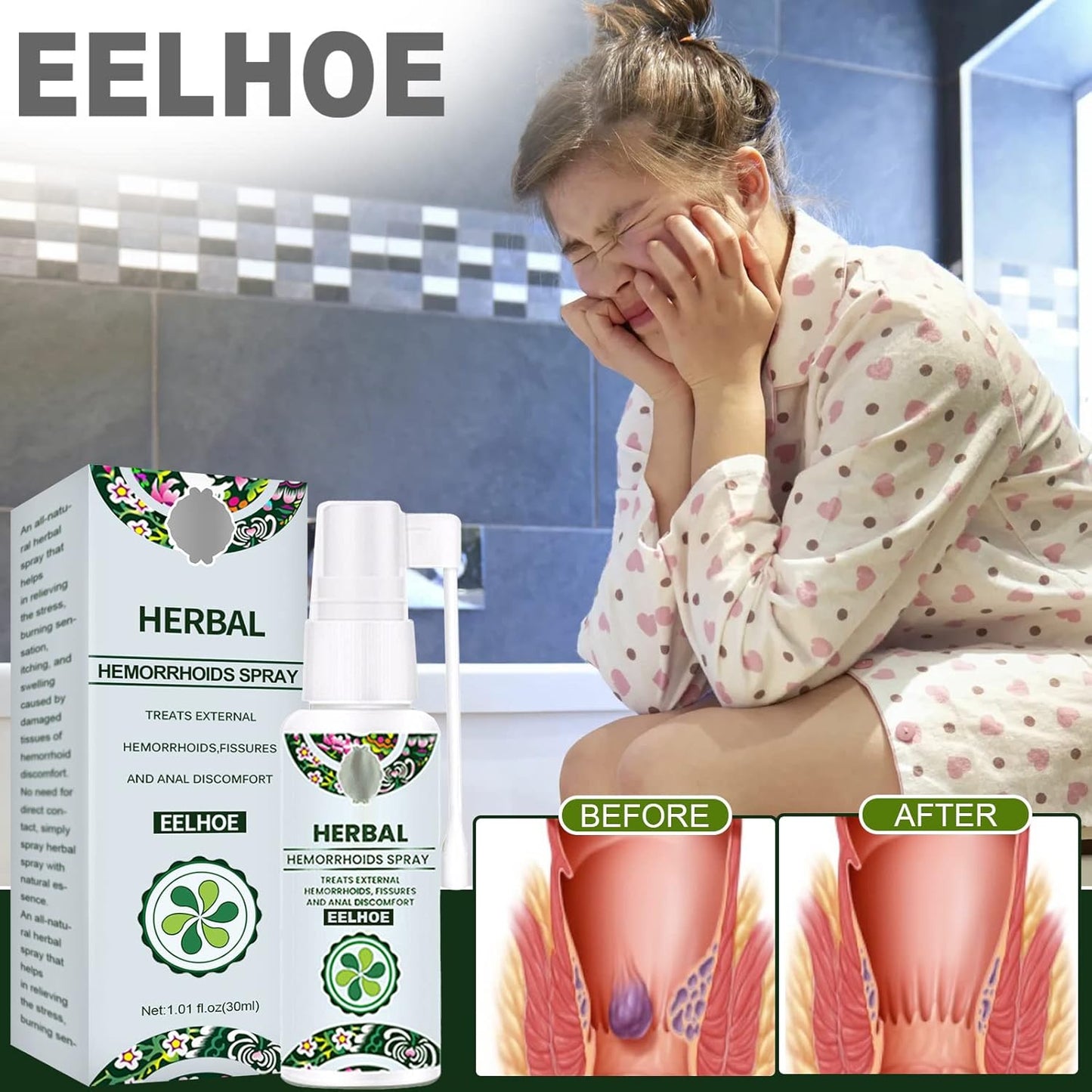 Hemorrhoid Relief Spray – Natural Herbal Soothing Treatment for Swelling, Itching & Discomfort Support