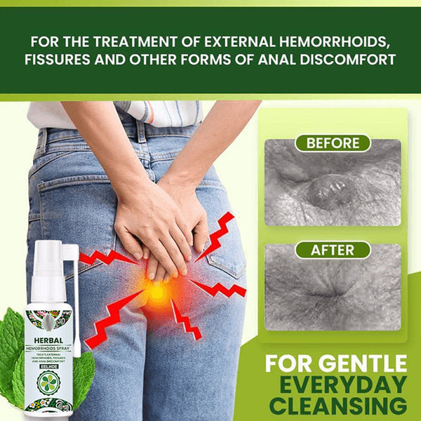 Hemorrhoid Relief Spray – Natural Herbal Soothing Treatment for Swelling, Itching & Discomfort Support