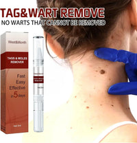 Jaysuing Liquid Wart Remover – Advanced Wart Removal Treatment for Face, Hands & Body