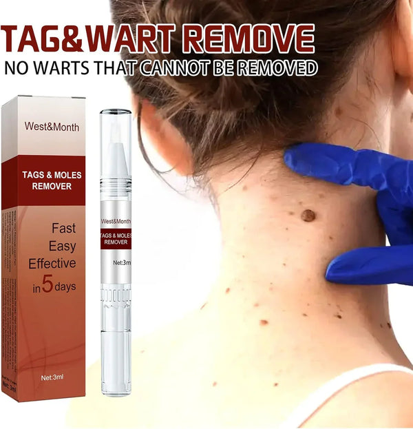 Jaysuing Liquid Wart Remover – Advanced Wart Removal Treatment for Face, Hands & Body