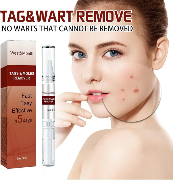 Jaysuing Liquid Wart Remover – Advanced Wart Removal Treatment for Face, Hands & Body