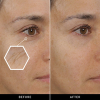 Botox Bee Venom Wrinkle Cream – Anti-Aging & Collagen Boosting Moisturizer for Firm, Tight, and Hydrated Skin