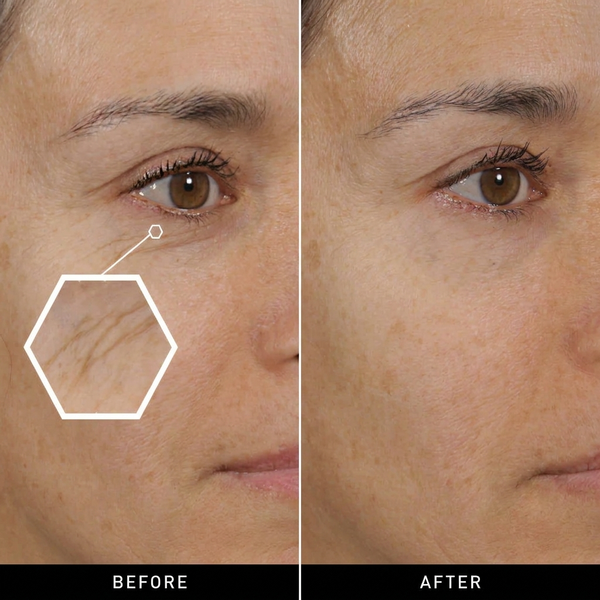 Botox Bee Venom Wrinkle Cream – Anti-Aging & Collagen Boosting Moisturizer for Firm, Tight, and Hydrated Skin