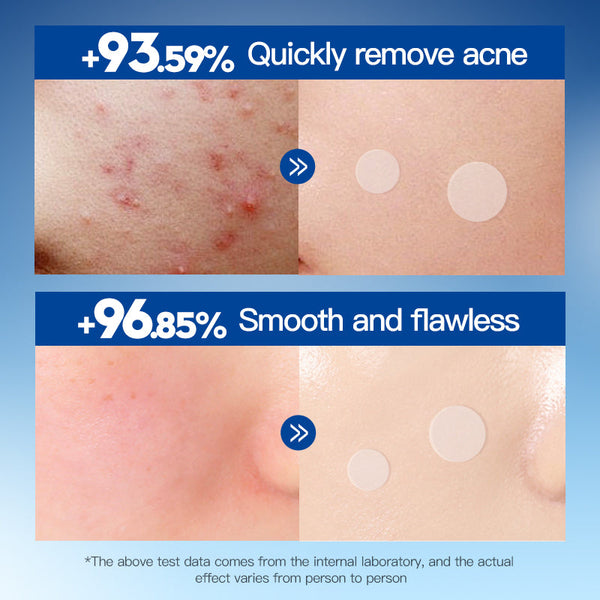 Derma Smooth Spot Corrector – Skin Tag & Mole Remover Patch