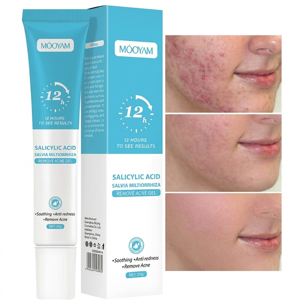 Salicylic Acid Remove Acne Gel 20G, Rapid Action Acne Spot Treatment for Face Closure And Acne Dots, Premium Acne Scar Gel And Pimple Remover