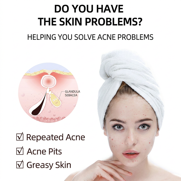 Salicylic Acid Remove Acne Gel 20G, Rapid Action Acne Spot Treatment for Face Closure And Acne Dots, Premium Acne Scar Gel And Pimple Remover