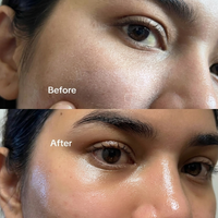 Celimax Vita A Retinal Shot Tightening Booster