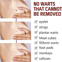Jaysuing Liquid Wart Remover – Advanced Wart Removal Treatment for Face, Hands & Body
