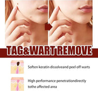 Jaysuing Liquid Wart Remover – Advanced Wart Removal Treatment for Face, Hands & Body
